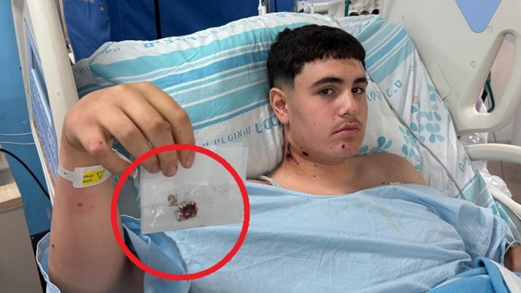 איתי מייסון (צילום: דוברות רמב"ם)