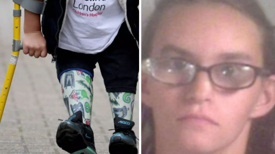 האם המתעללת ורגליו התותבות של טוני