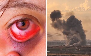 בעיות עיניים במלחמה (צילום: שאטרסטוק+אבי ששון)