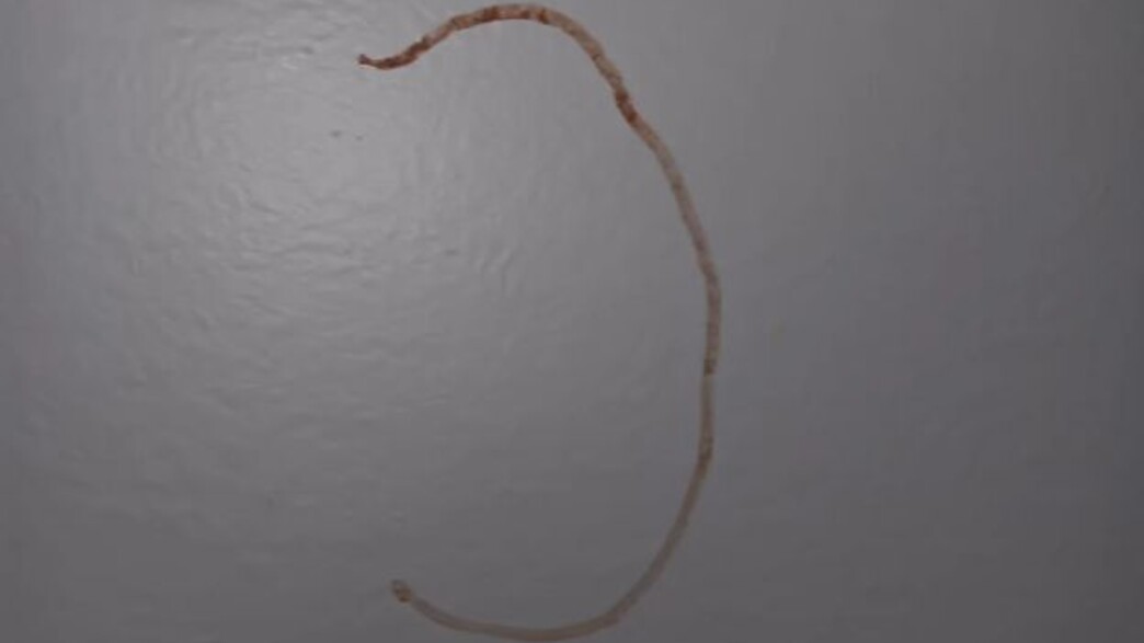 שובל של דם על הקיר שובל של דם על הקיר