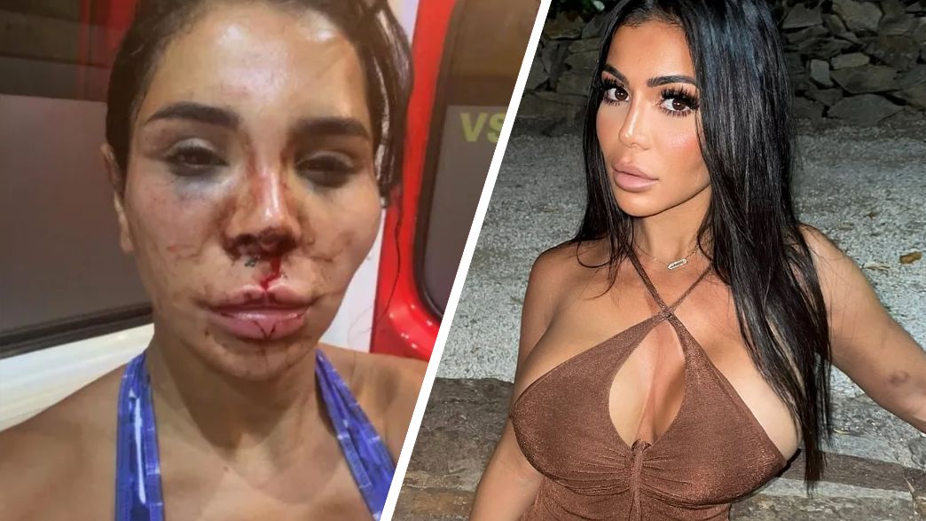 סורייה ריפי סורייה ריפי