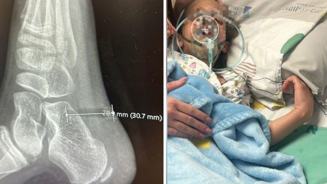 הילדה הפצועה