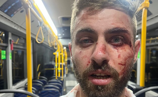 נערים תקפו באלימות נהג אוטובוס בירושלים