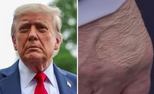 היד של טראמפ, טראמפ