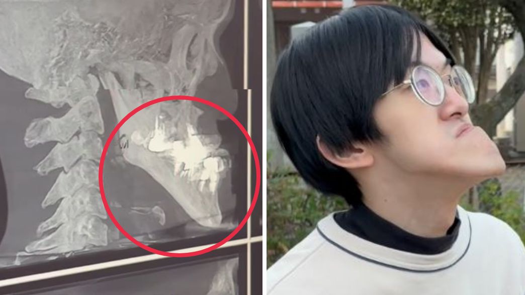 בעל הסנטר הארוך בעולם