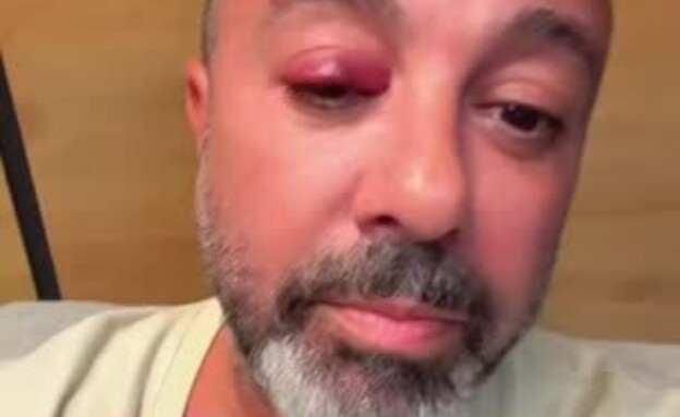 ליאור נרקיס מסתלבט (צילום: רשתות חברתיות לפי סעיף 27 א')