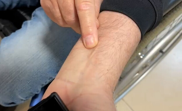 נרפאתי על ידי חייזרים