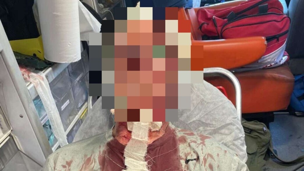 בן ה-78 שהותקף בבניין בהרצליה בן ה-78 שהותקף בבניין בהרצליה