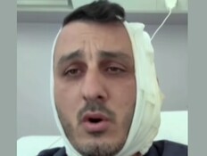 הישראלי שאוזנו ננשכה על ידי סורי ביוון (צילום: חדשות 12, shutterstock)