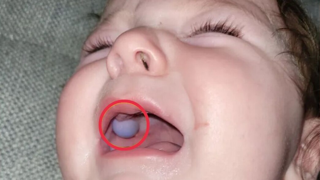 רוון סטיינר