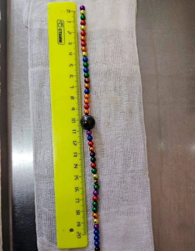 וורונז' (צילום: מתוך הרשתות החברתיות בהתאם לסעיף 27א' בחוק)