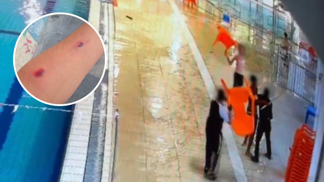 תיעוד התקיפה בבריכה תיעוד התקיפה בבריכה