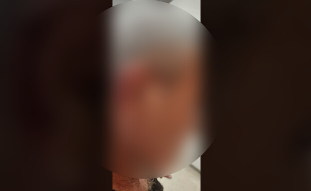 ד' הותקף מחוץ לביתו (צילום: באדיבות המשפחה)