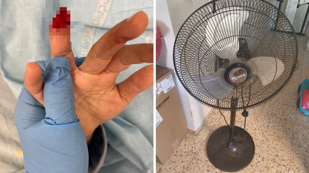 אצבע נקטעה אצבע נקטעה