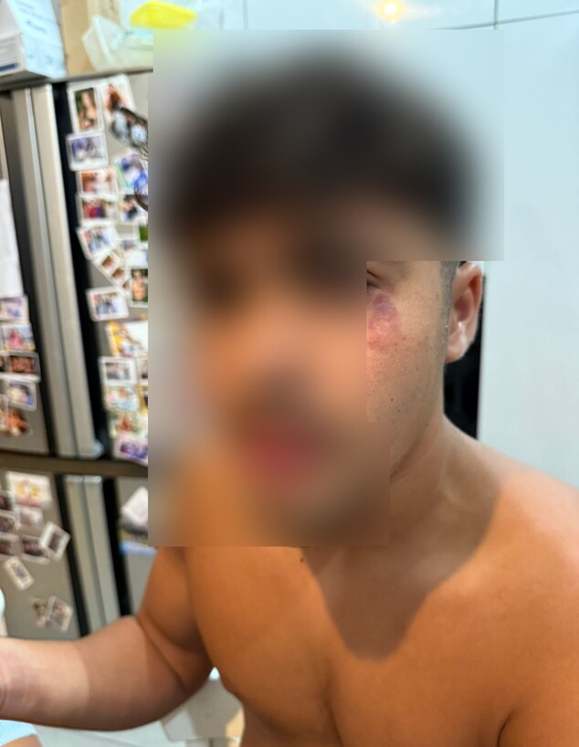 שקד צעיר ישראלי הותקף בכרתים