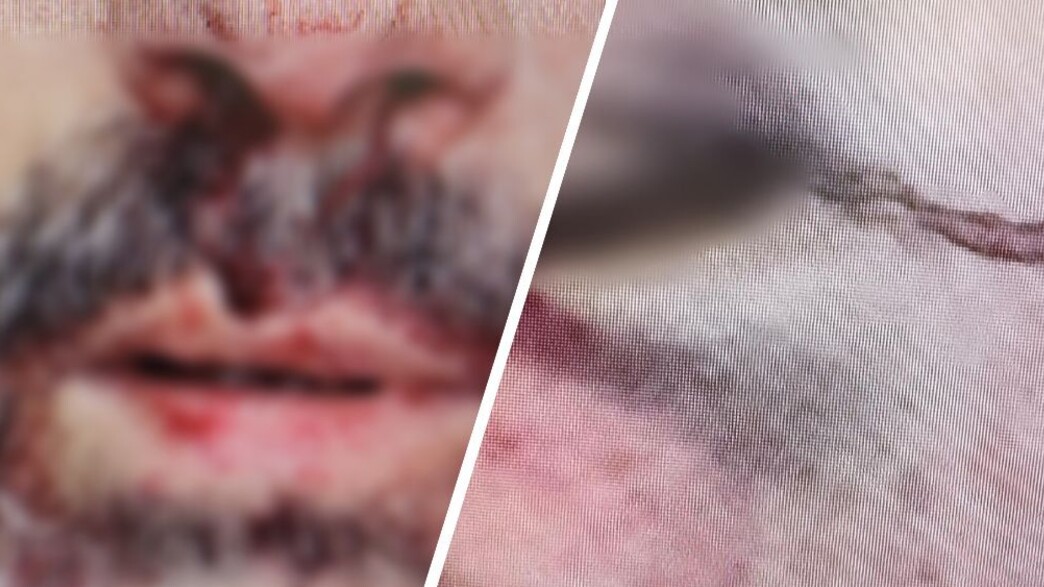 תקיפה בכביש