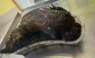 טריכופגיה (צילום: מתוך הרשתות החברתיות לפי סעיף 27א׳ לחוק זכויות יוצרים)