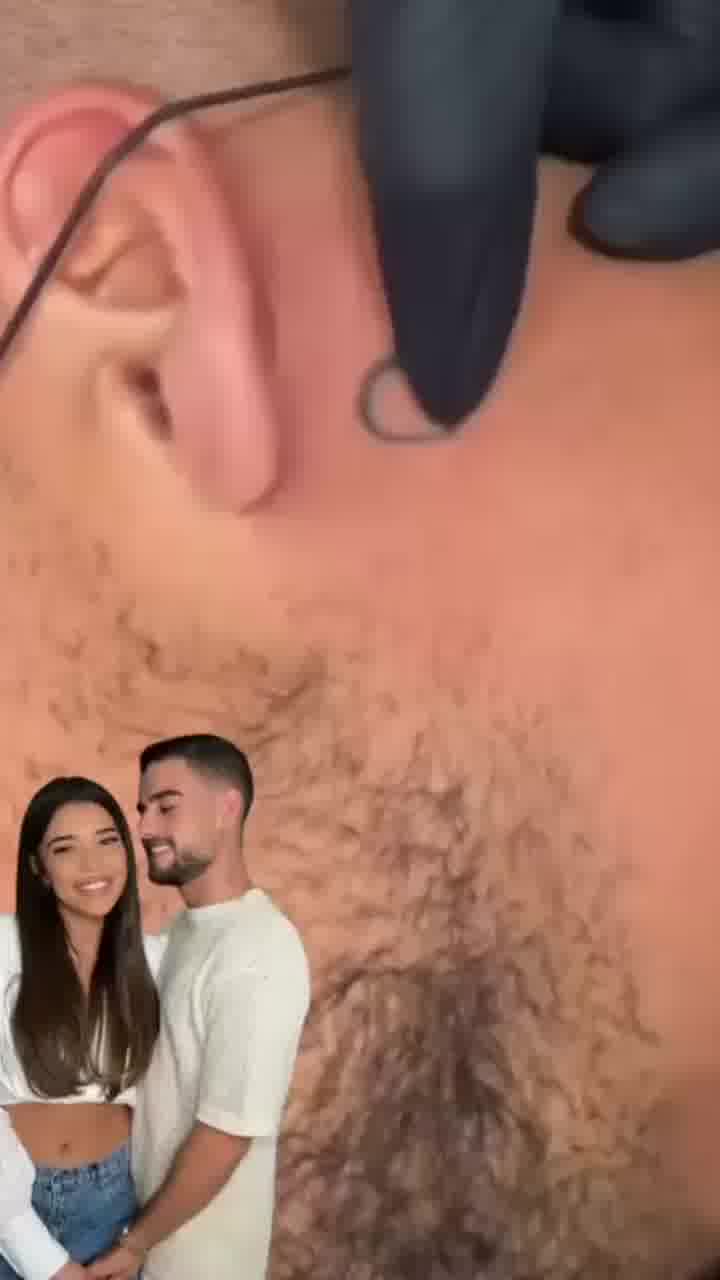 אחרי ששי לי עופרי השלימה לשניר בורגיל את קעקוע הלב לפני החתונה - הוא החליט לפתוח אותו מחדש