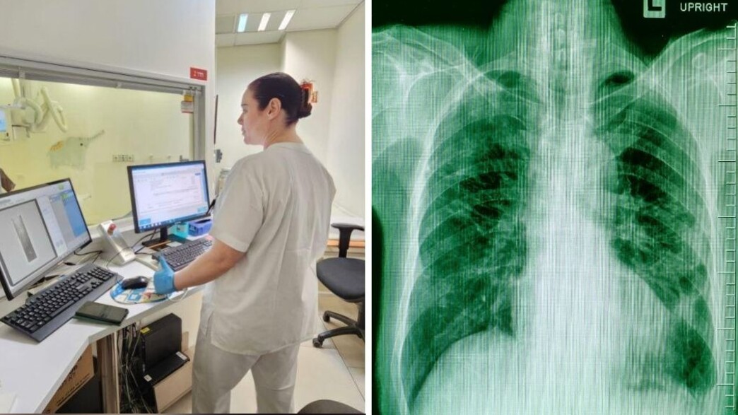 רנטגן רנטגן