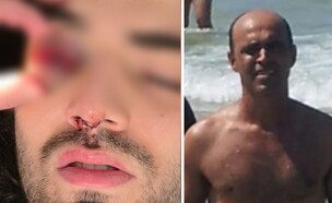 מימין: אברהם טיראן-שי-מור והצעיר שאיבד את ראייתו