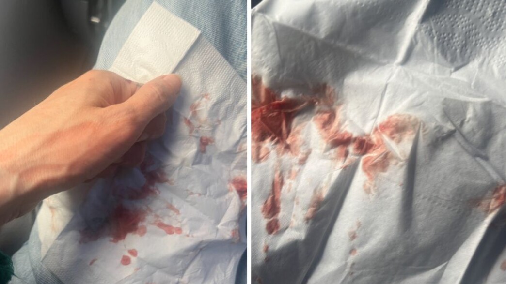 לחץ באוזניים