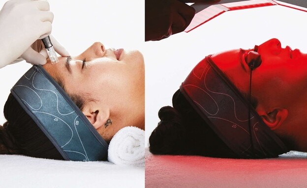 פילינג לא פולשני של דרמולוגי'קה פילינג לא פולשני של דרמולוגי'קה