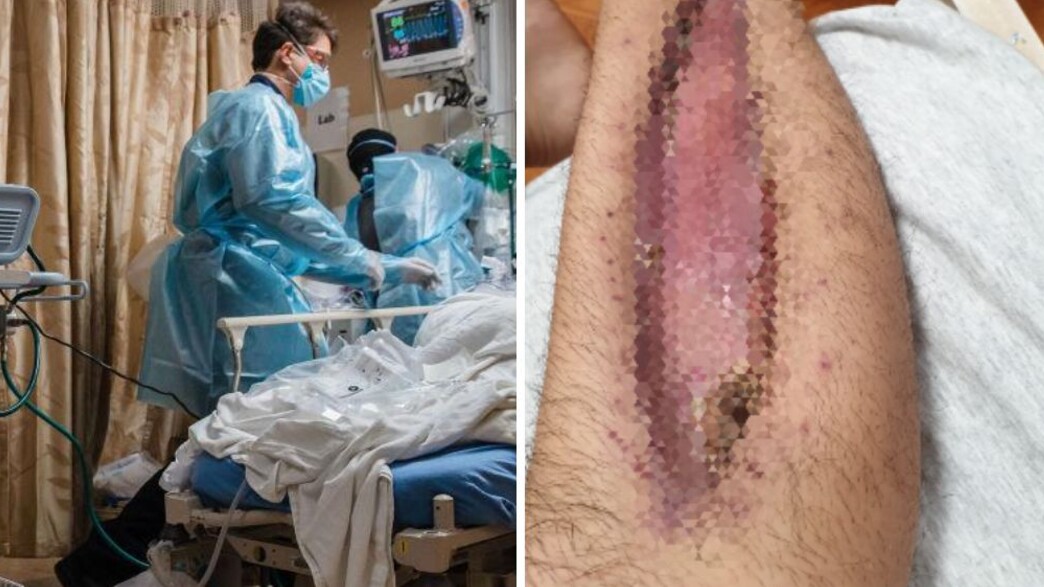 הנזק לצמיתות