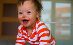 תסמונת דאון (צילום: shutterstock)