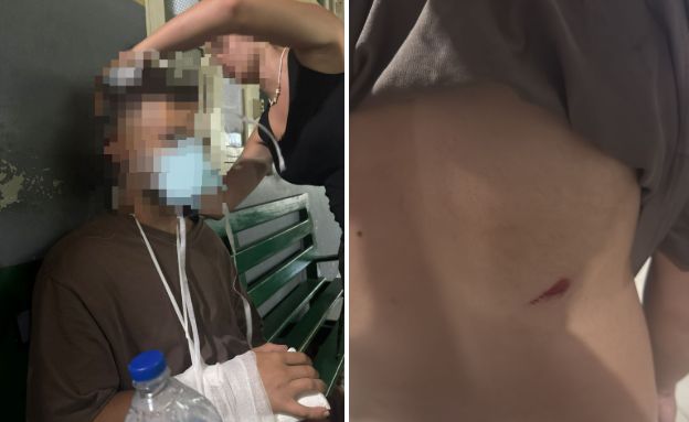 ישראלים הותקפו בסרי לנקה (צילום: פרטי)