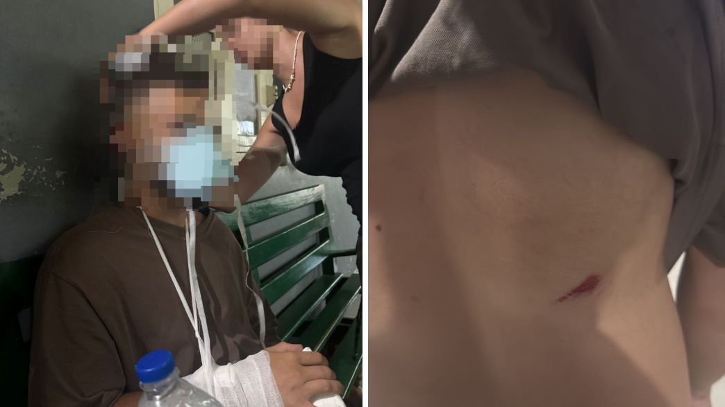 ישראלים הותקפו בסרי לנקה