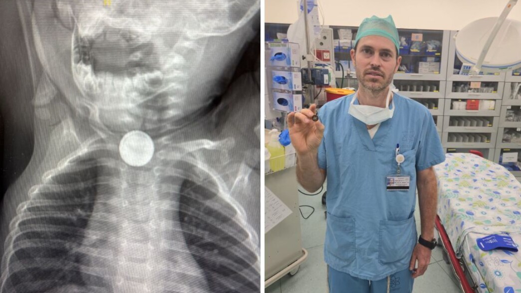 הסוללה שנשלפה הסוללה שנשלפה