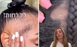 טרנד הקוקו המתוח (צילום: אינסטגרם)