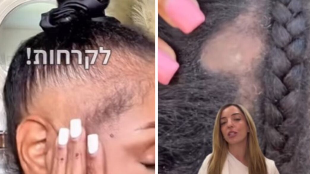 טרנד הקוקו המתוח