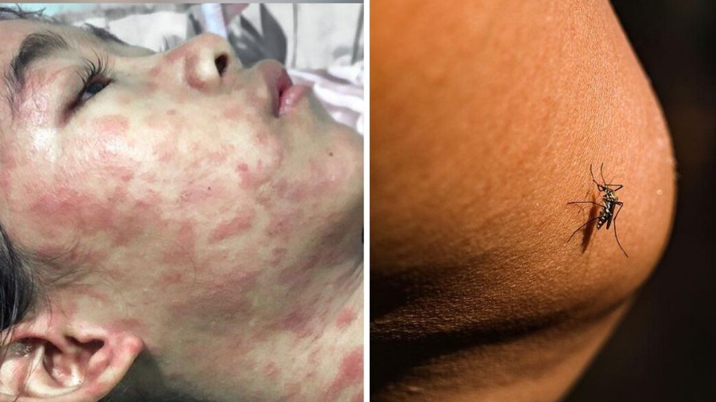 הנגיף בסין הנגיף בסין