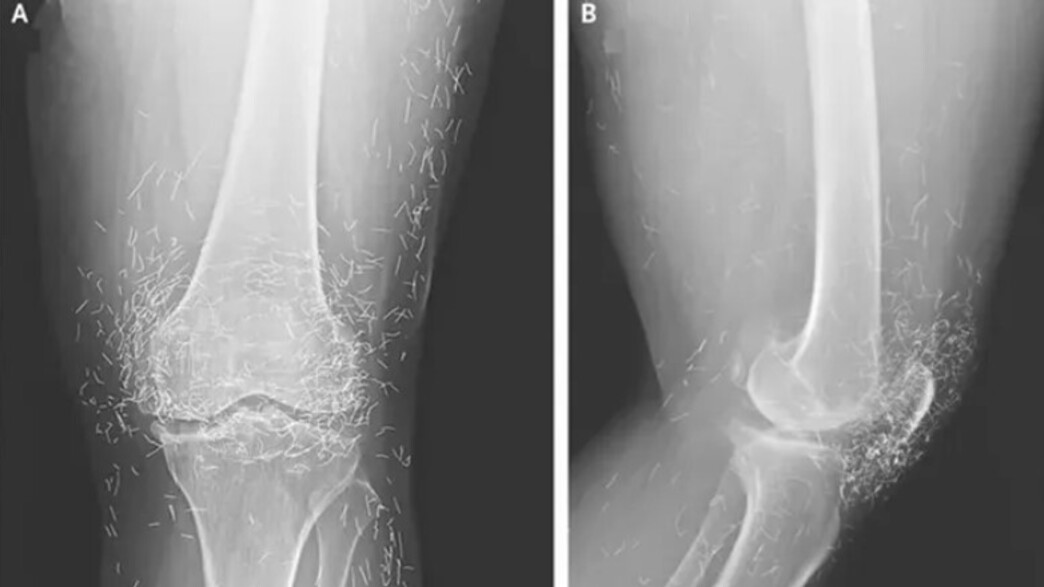 הגיעה למיון בגלל כאבים בברכיים - וגילתה בעיה מחרידה הגיעה למיון בגלל כאבים בברכיים - וגילתה בעיה מחרידה