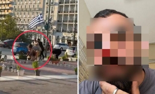 ישראלי שהותקף בחופשה ביוון  (צילום: פרטי)