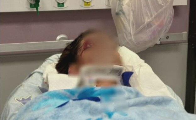 רוכב קורקינט שנפצע רוכב קורקינט שנפצע