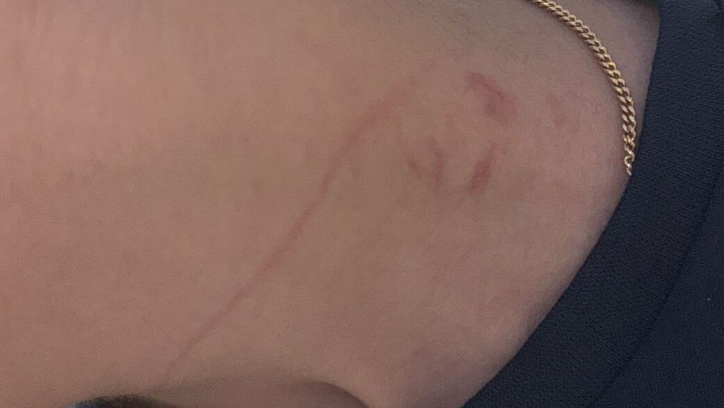 אירוע התקיפה החמור בבית ספר באשקלון אירוע התקיפה החמור בבית ספר באשקלון