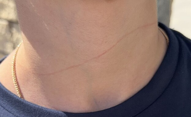 אירוע התקיפה החמור בבית ספר באשקלון אירוע התקיפה החמור בבית ספר באשקלון