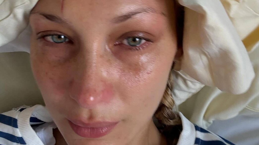 בלה חדיד בלה חדיד