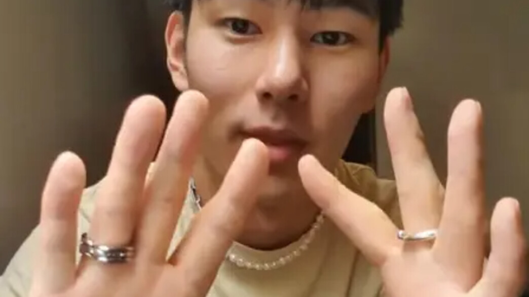 קיאו אלברס שנולד בלי אגודלים