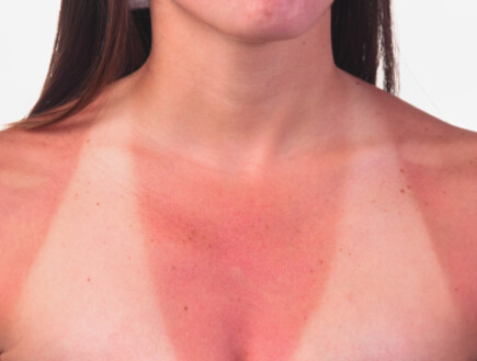 אישה עם מחשוף שרוף