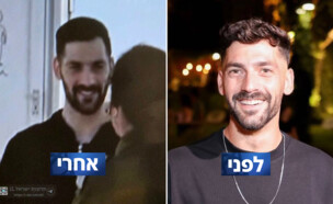 גלי ברמן לפני ואחרי