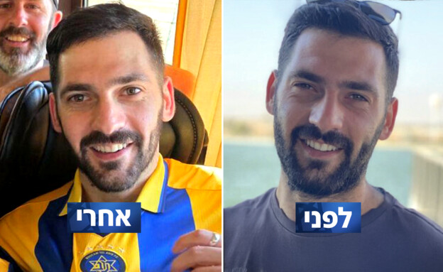 גלי ברמן לפני ואחרי