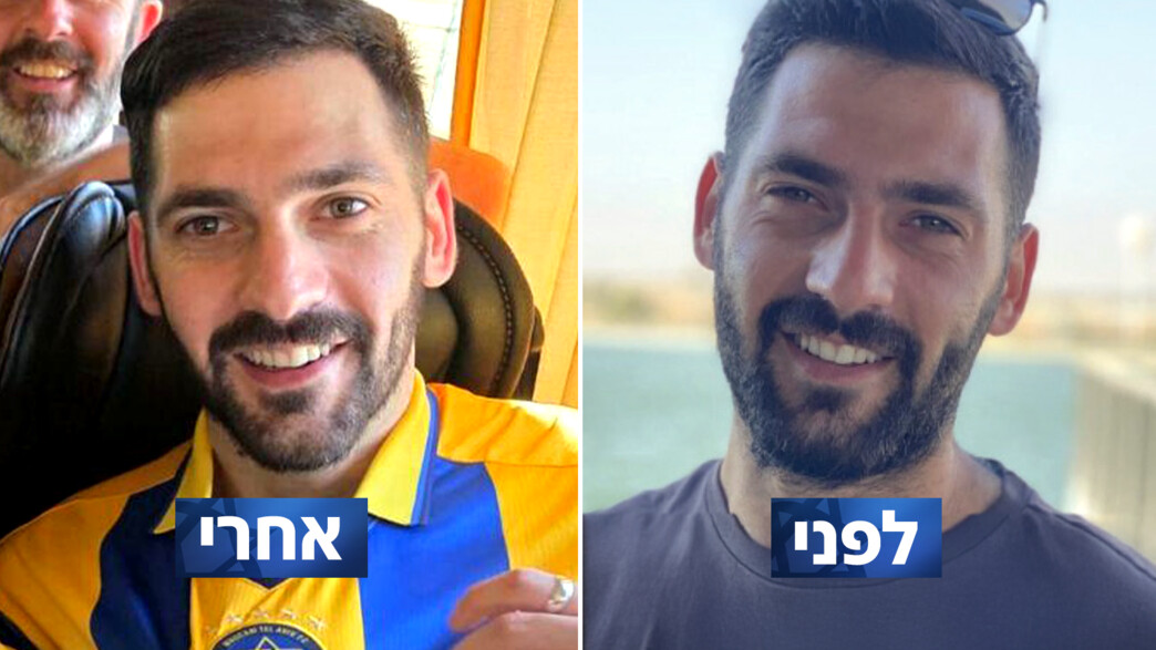 גלי ברמן לפני ואחרי