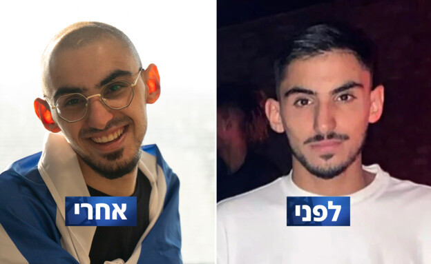 רום ברסלבסקי לפני ואחרי
