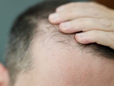 דיכאון, חרדה ואובדנות בעקבות שימוש בתרופה הנפוצה