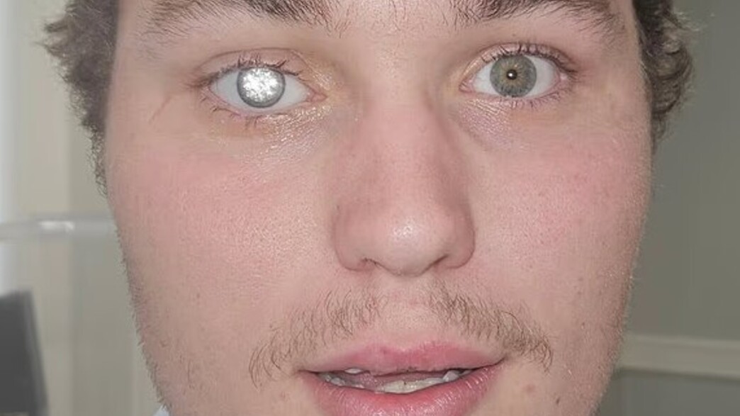 עין היהלום עין היהלום