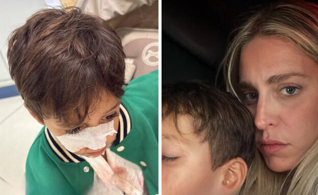 יוכי אפוליאון משתפת שבנה הותקף על ידי כלב (צילום: instagram)