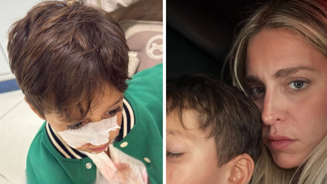 יוכי אפוליאון משתפת שבנה הותקף על ידי כלב